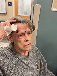 Knee and head injury updates