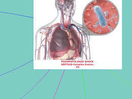Maybe you would like to learn more about one of these? Fisiopatologia Shock Septico Cevallos Evely Mindmap