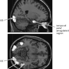 Book doctor appointment consult doctor online. Pdf Autism Asperger Syndrome And Brain Mechanisms For The Attribution Of Mental States To Animated Shapes