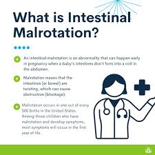 Image result for Intestinal Malrotation