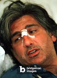 Image of FRENCH PHILOSOPHER DANIEL SCHIFFER WOUNDED IN KOSOVO, 1999-05-31  (photo)