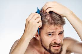 Its hypoglycemic and immunomodulatory properties may cause adverse effects in those with autoimmune disease or allergies. Do Beta Blockers Cause Hair Loss Male Ultracore Blog