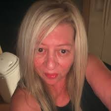 Hummingbird visitors in Auburn, KY