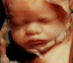 If you are less than 14 weeks pregnant a vaginal ultrasound will help us get the best information. 3d 4d 5d Hd Live Ultrasound 5d Hd Phoenix Metro