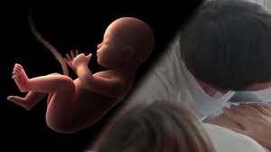 Maybe you would like to learn more about one of these? 40 Ssw Und Keine Wehen Tipps Und Infos Focus De