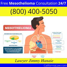 Beverly Hills Mesothelioma Lawyer Ca Find Best Beverly Hills Mesothelioma Law