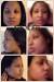 Emu Oil For Hair Loss After 3 Months