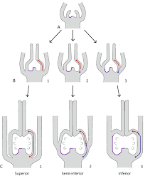 Image result for Melastomastrum segregatum