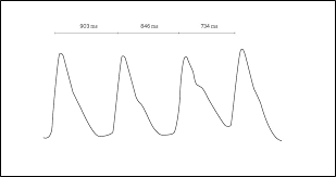 What Is Heart Rate Variability What Hrv Tells You About