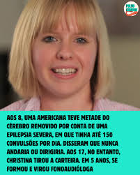 Cameron Mott, dos EUA, foi diagnosticada aos 3 anos com uma forma rara de  epilepsia chamada síndrome de Rasmussen. Aos 8, passou por uma  hemisferectomia — cirurgia em que metade do cérebro