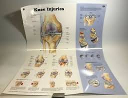 Details About The Knee Injuries Anatomical Charts 20x26 Laminated