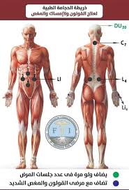 القولون العصبي والحجامة مواضع الحجامة الحجامة علاجك الطب البديل Facebook