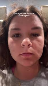 emma skinner (@emma.poopyhead2)