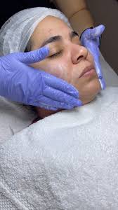 Tratamientos Faciales