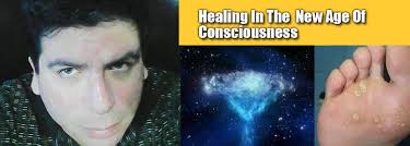 Plantars Warts: Healing The Virus From Within