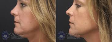 Cosmetic Surgery Photo Gallery