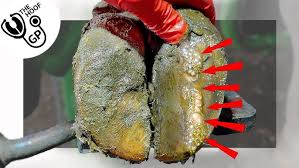 4 SYMPTOMS OF FOOT FUNGUS!