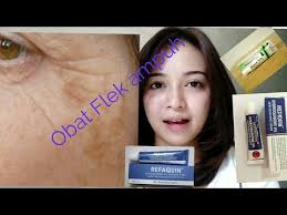 Ingat tekan tombol wa dibawah untuk pemesanan All About Hyperpigmentation Dan Obat Melasma Yang Dapat Digunakan Youtube