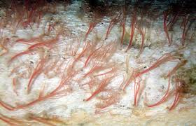 However, the largest animals on the planet, the blue whale, along with the largest fish, the whale shark, are not equipped to swallow humans, having tiny esophagi which would cause them to choke on us. What Happens When Whales Die Natural History Museum