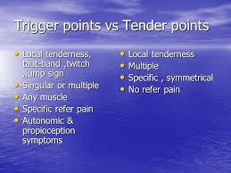 Image result for Tender Point