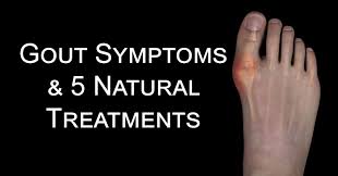 Fish, such as cod, scallops, mussels, and salmon. Gout Symptoms 5 Natural Treatments David Avocado Wolfe