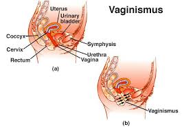 Maybe you would like to learn more about one of these? What Is Vaginismus
