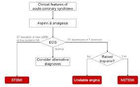 We review a stepwise approach to interpreting the ecg in patients. Acute Coronary Syndrome
