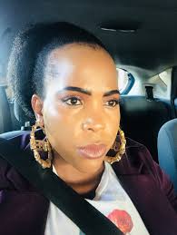 Tips for fixing hairline and volume?