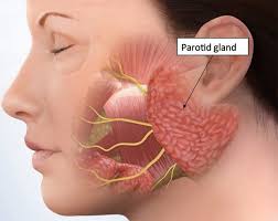 Parotid Gland Salivary Gland Salivary Gland Infection Swelling Remedies