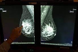 Each cancer type would look different on an mri, ct scan or pet scan. Breast Cancer Faq 8 Things You Should Know About Getting Your First Mammogram Daily Sabah
