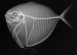 Pin On X Ray