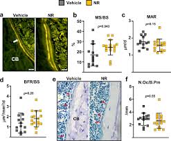 Nerve root anatomical structure labeled cross section. A Decrease In Nad Contributes To The Loss Of Osteoprogenitors And Bone Mass With Aging Npj Aging And Mechanisms Of Disease