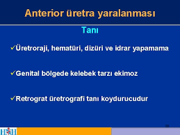 1 travma 14 lmden biri 1 37 ya
