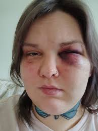 Hi. I was referred to this group by our early intervention worker. I have 2  young boys and I've been having issues with my WIC, Food Stamps and Cash  Assistance. I don't