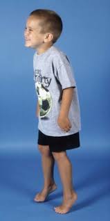 Image result for Pediatric Limp