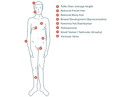 Klinefelter Syndrome Symptoms Causes Healthy Male