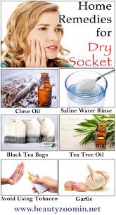 Home Remedies For Dry Socket Also Known As Alveolar Osteitis Remedies For Tooth Ache Dry Socket Oral Care