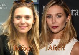 Elizabeth Olsen Nose Job Jpg 500 350 Nose Job Elizabeth Olsen Nose
