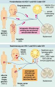Symptome eines genitalherpes bei frauen und männern. Virusinfektionen Springerlink