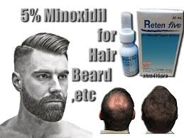 What is minoxidil & how does it promote hair growth? Reten Five Minoxidil 5 Extra Strength Men 1 Month Supply Hair Regrowth Solution Retenfive Hair Loss Regrowth Treatment Hair Loss Men Mens Hair Loss Treatment
