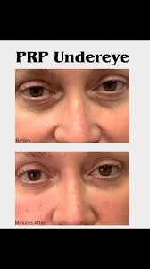 Watch how a HydraFacial works its magic—cleansing, exfoliating, and  hydrating for that radiant, fresh-faced glow. Perfect for all skin types!  Ready to treat yourself? Call us at 615-721-5121 to book your glow-up! #