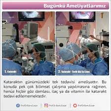 Kataraktin Gunumuzdeki Tek Tedavisi Ameliyattir Bu Konuda Pek Cok Bilimsel Calisma Yapilmasina Ragmen Henuz Hicbir Goz Damlasi Ilac Ya Da Pekin Vitamin Ordu