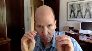 Multiple Myeloma Specialists- Why?