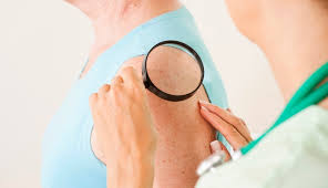 Ligamentous laxity causing knee hyperextension may also cause inflammation of hoffa's pad. Evidence Lacking To Assess Benefits Harm Of Visual Skin Cancer Screening Clinical Advisor