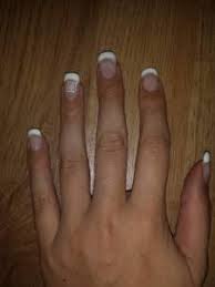 Eingerissener nagel | schnell und einfach reparieren | lyninails Meinungen Erwunscht Gelnagel