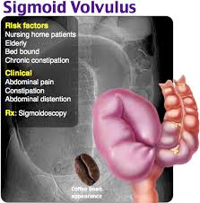 Rosh Review Diagnostic Medical Sonography Medical Mnemonics Medical Knowledge