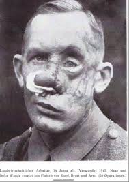 Jacques Joseph (1865–1934). Ein Streifzug durch die Geschichte der  Schönheitschirurgie