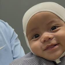 Fundraiser by Paola Rios : Support for Baby's Plagiocephaly Helmet