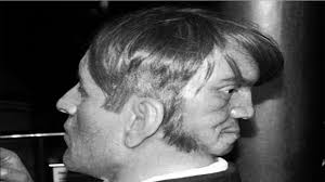 Edward Mondrake: La verdadera historia del hombre con dos rostros y su  trasfondo científico