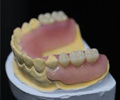 Bagaimana jadinya jika kita masih muda, tapi ada beberapa gigi kita yang sudah hilang ? Focus Dental Lab Thermosent Thermosent